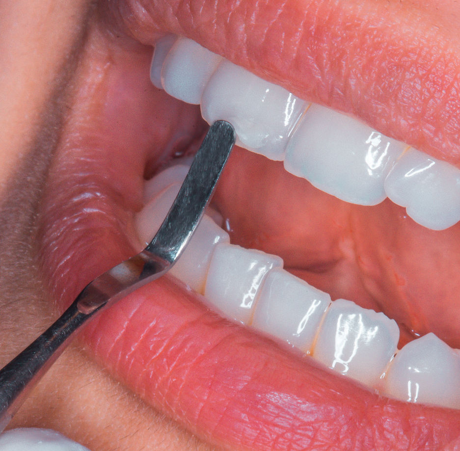 3ae9b5_c9aff00a71f9424dbba69f46ea296179_mv2